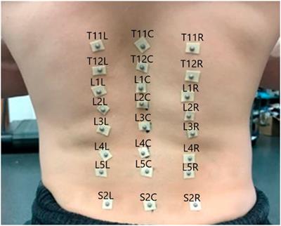 Dynamic segmental kinematics of the lumbar spine during diagnostic movements